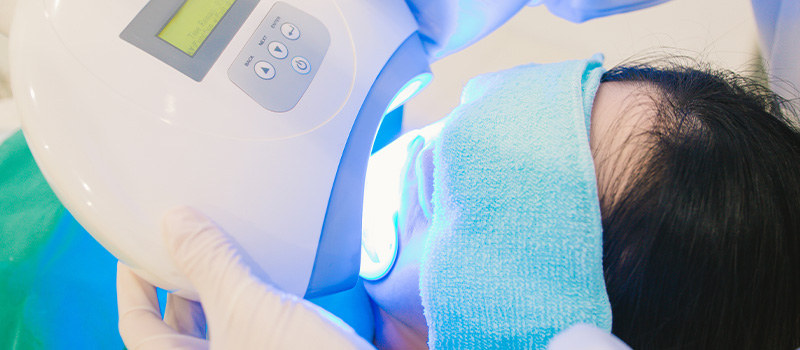 ホワイトニングを行う前に